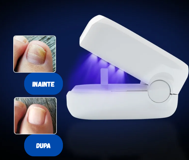 Aparat Magic pentru Unghii Sănătoase